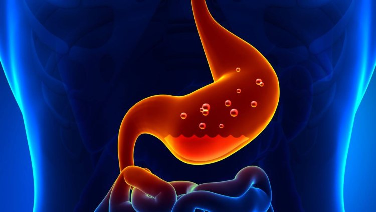 Best Diets for Managing Stomach Ulcers