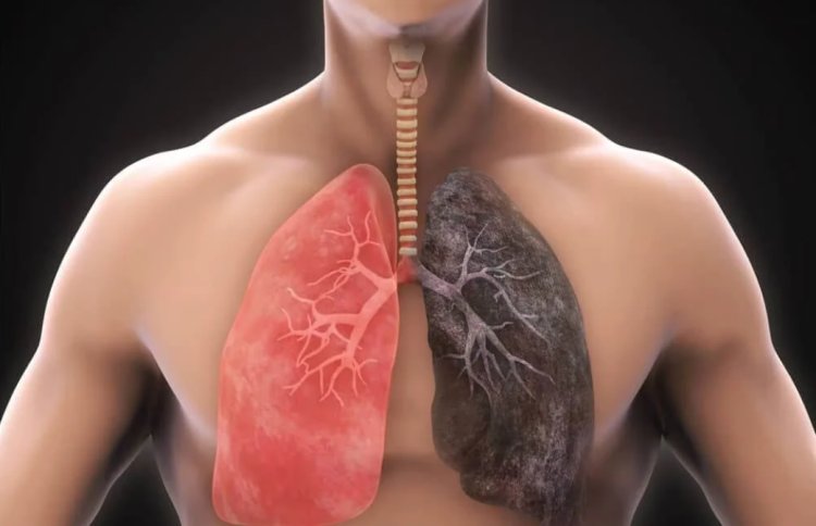 8 Early Symptoms of COPD That Shouldn't Be Ignored