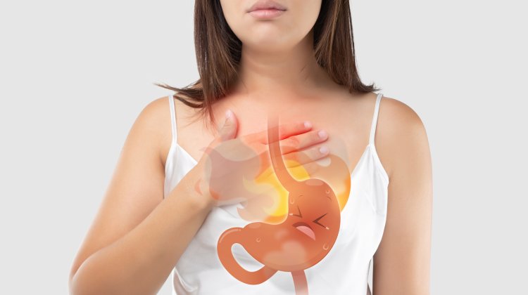 Top Medicines for Managing Acid Reflux